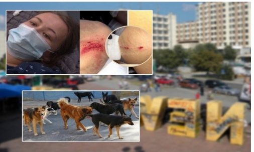 FOTO/ Pamje të rënda, gruaja shqiptare shtatzënë kafshohet nga qentë e rrugës