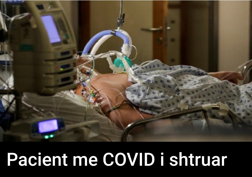 Studimi: Truri i pacientëve me COVID mund të plaket 10 vite para kohe