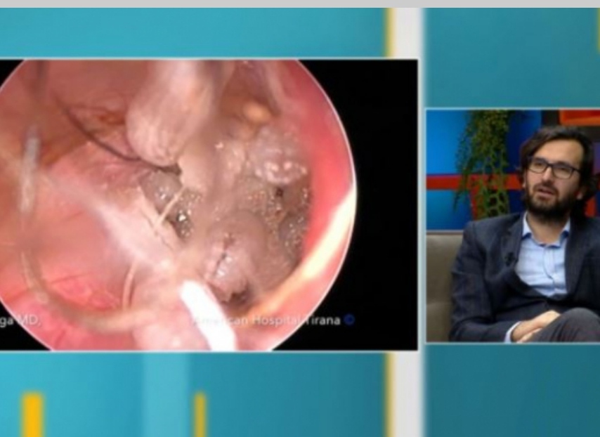 Rasti i çuditshëm në Shqipëri: Dyshuan për tumor, por i gjetën larva në vesh