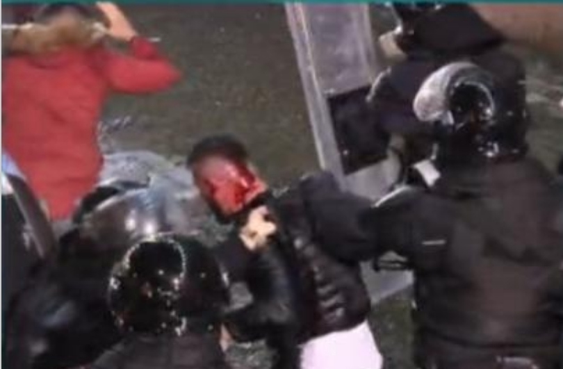 Pamje të rënda! Efektivi i FNSH-së lan në gjak të riun protestues (FOTO&VIDEO)