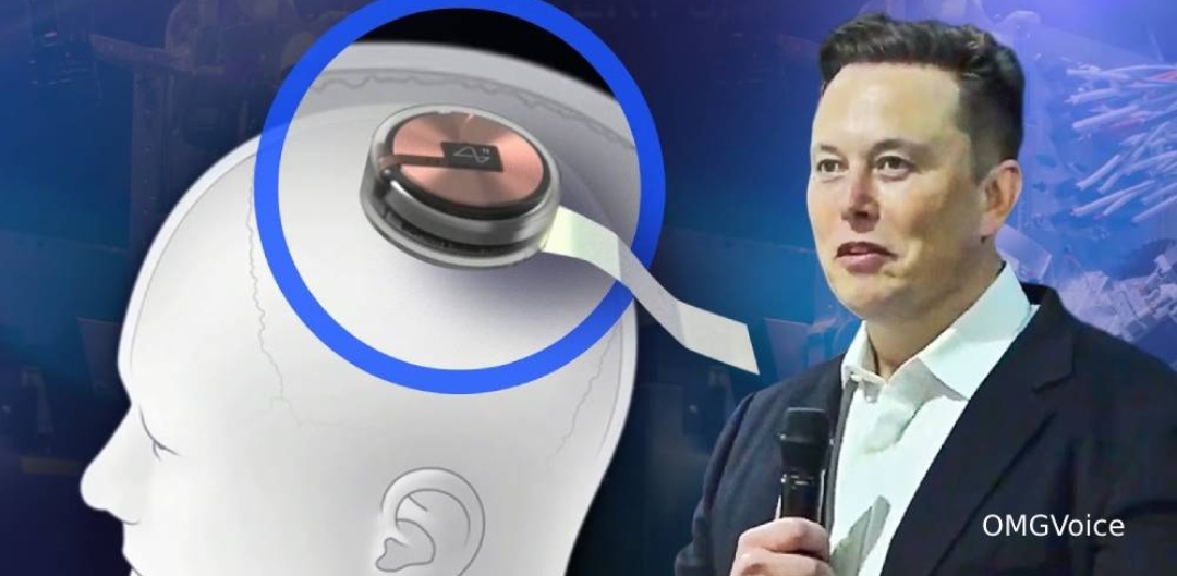 Në 2022-n do të vendosë çipa në trurin e njerëzve, Elon Musk në qendër të mediave për risinë e tij
