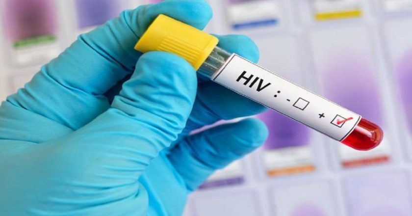 Studimi fundit: Njerëzit me ngarkesë të ulët virale të HIV, nuk e transmetojnë infeksionin