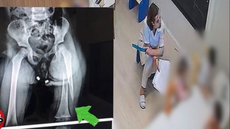 Apo kur e përplase ti?”, “dalin pamjet si edukatorja u mundua të fshehte ngjarjen: Foli mamit të vajzës…