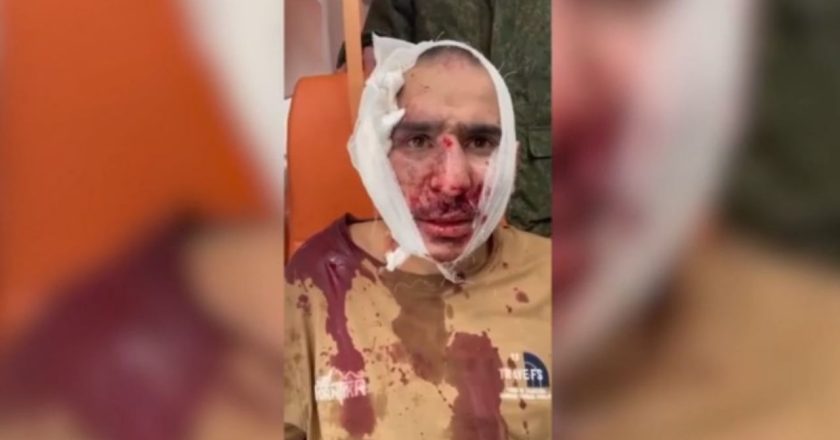 Pamje të rënda/ I mbuluar nga gjaku, momenti i arrestimit të terroristit të sulmit në Moskë, i presin veshin dhe e detyrojnë të…
