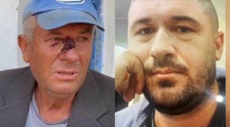 Nuk i dha djersën e ballit, 33 vjecari shqiptar i jep fund jetës! I ati flet mes dhimbjes së madhe ‘Më premtoi se nuk do e bënte! Pronari nuk i jepte leket…’-Çkemi News