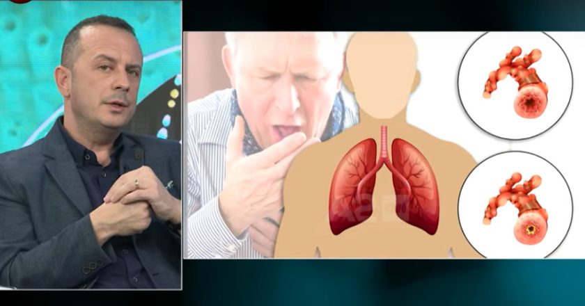 Kolla me gëlbazë një shenjë alarmi, njihuni me sëmundjet që kërcënojnë mushkëritë-Çkemi News