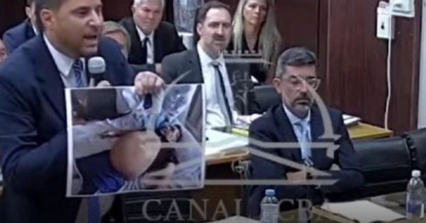 Kështu vdiq Maradona”, prokurori tregon në gjyq foton tronditëse-Çkemi News