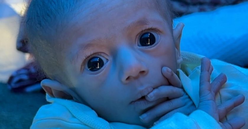 “Jetë në kufijtë e vdekjes”/ Vogëlushja 5-muajshe në Gaza që sfidon urinë dhe luftën-Çkemi News