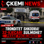 TRONDITET SHKODRA! Babë e bir sulmojnë 32-vjeçarin pranë Poliklinikës, pamjet e rënda po bëjnë xhiron e rrjetit