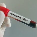 Tre viktima nga hantavirusi në Venezuelë, autoritetet: Rastet janë të izoluara